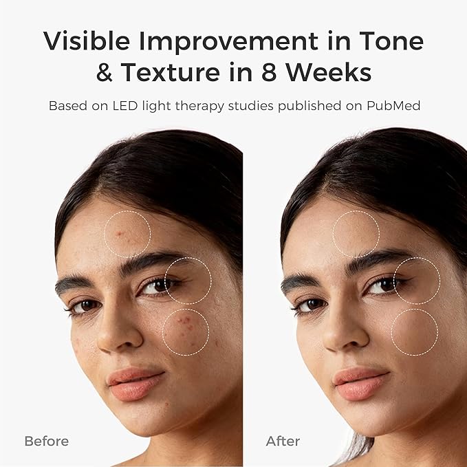 Red Light Therapy Mask for Face – Portable Wireless LED Face Mask with 3 Modes (Red, Blue, Infrared 850nm), Cordless Anti-Aging Light Therapy for Wrinkle Reduction, Acne Care & at-Home Skin
