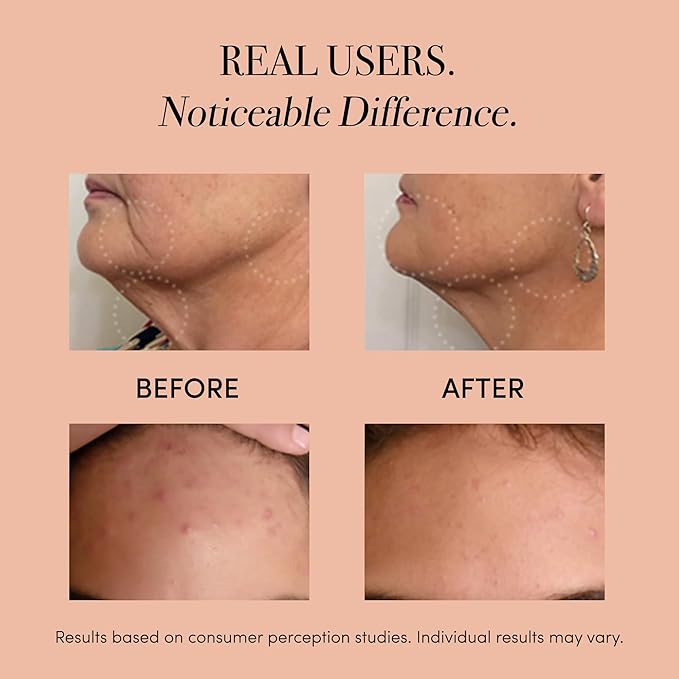 reVive Light Therapy Lux Collection Soniqué Cleanser, Sonic Face Cleanser Brush with Medical-Grade Red Light Therapy for Face, Water-Resistant