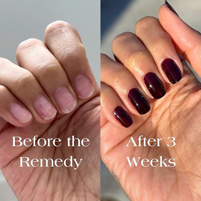 Botanist The Remedy | Nail Strengthening Polish | Repairs & Hardens Nails Damaged from Acrylics, Dip & Gel Manicures | Non-Toxic, 84% Plant Based, 21-Free & Vegan (Cherry Mocha)