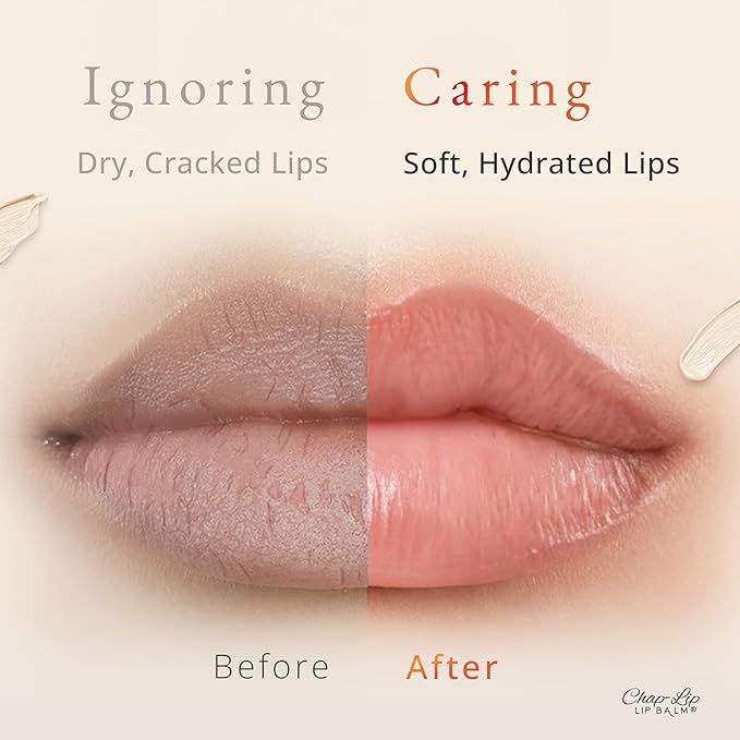 CHAP-LIP Original Lip Balm Hydrating Bulk Chap Stick with Fruit Flavors, Coconut Oil, Cocoa Butter - Christmas Gift Stocking Stuffers Lip Therapy Pack for Men and Women - Made in USA, 24 Pack x 12 Box