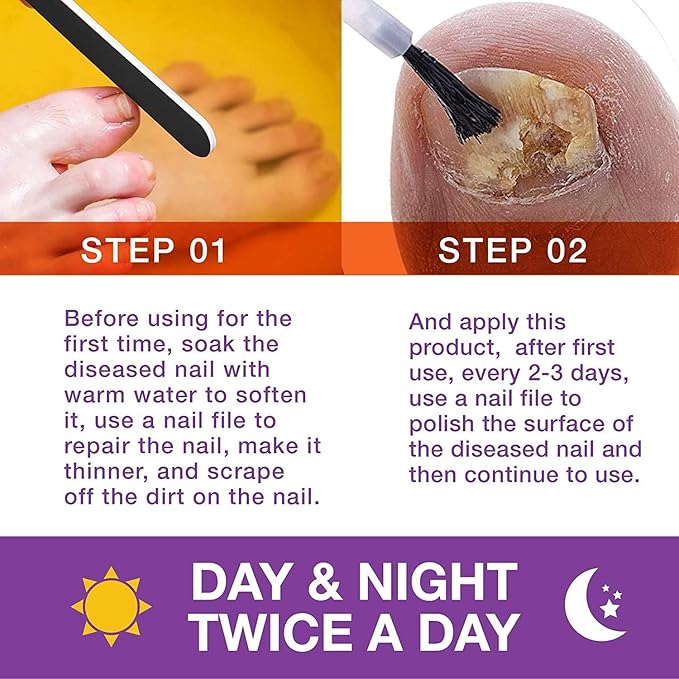 Toenail Fungus Treatment Extra Strength: Nail Fungus Treatment for Toenails and Fingernail for Damaged Discoloration Nails 1.0 Oz （New Formula）
