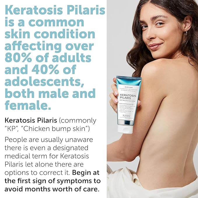 Keratosis Pilaris Treatment | Keratosis Pilaris Lotion with 10% AHA | Gentle Exfoliation For Strawberry Legs, KP & Ingrown Hairs | Smooth & Hydrating Body Lotion For Redness, Dry, Rough And Flaky Skin