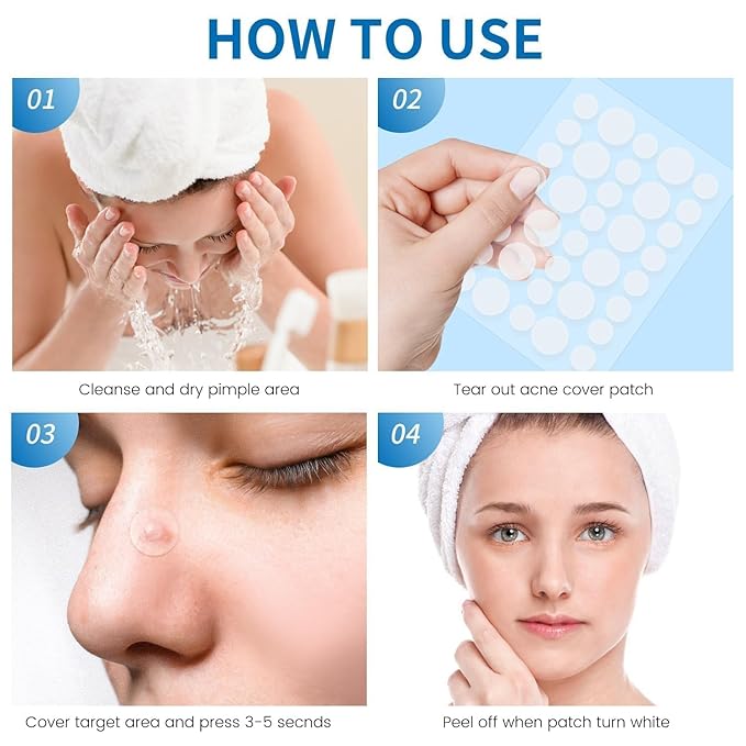 180 Count Original Pimple Patches for Face, Hydrocolloid Acne Pimple Patch with Tea Tree Oil for Party Gift Covering Zits Blemishes