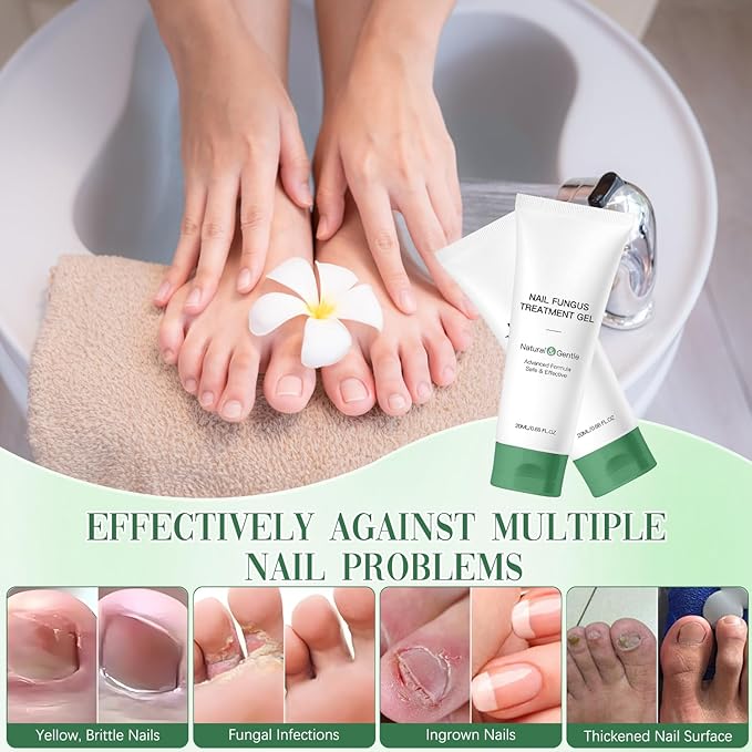 2PCS Nail Fungus Repair Gel – Multi-Purpose Nail Repair, Nail Growth Serum for Damaged Nail