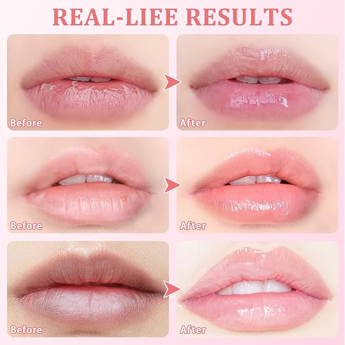 5 Pcs Bee Balm,Honey Strawberry Watermelon Bee Lip Balm Honey Pot,Moisturizing Lip Mask Overnight,Hydrate Repair Prevent Dry Cracked Lip Care (Honey+Strawberry+Watermelon+Apple Lime+Cherry)