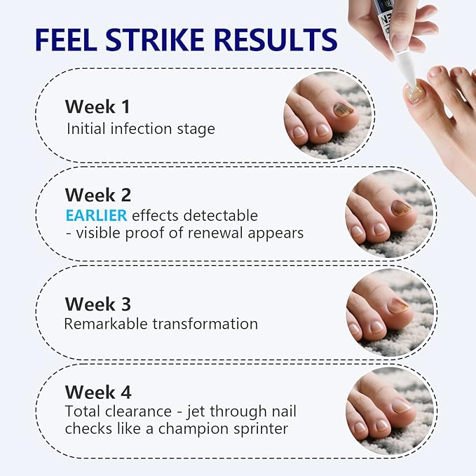 4-PACK Nail Fungus Pen - Toenail Fungus Treatment Extra Strength 25% Undecylenic Acid, Fast-Acting 7 Days Toe Nail Fungus Treatments, Tea Tree Oil, Acetic Acid Fungal Nail Repair Pens for Damaged Nail