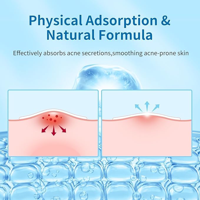 180 Count Original Pimple Patches for Face, Hydrocolloid Acne Pimple Patch with Tea Tree Oil for Party Gift Covering Zits Blemishes