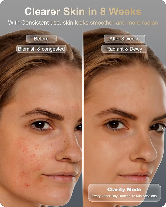 Lumefu Nimbus 3D FDA-Cleared Red Light Therapy Mask For Face 2026, Valentines Day Gift Anti-Aging & Acne Full Face Coverage 3 Treatment Modes 850nm NIR & Blue LED, Cordless Portable Home Use & Travel