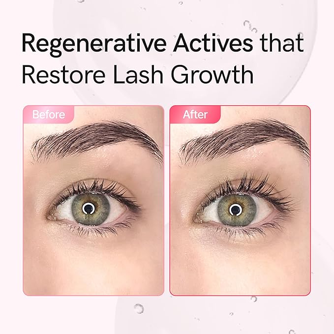 Lash Serum for Damaged, Thin or Extension-Weakened Lashes | PDRN, EGF, 9 Peptides, 20 Amino Acids,| Eyelash & Brow Growth Serum | Gentle Korean Formula, Prostaglandin-Free (0.3fl oz)