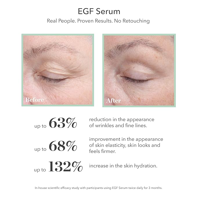 BIOEFFECT EGF Serum with Hyaluronic Acid and Barley Growth Factor, Best Rejuvenating Facial Treatment Fights Wrinkles, Hydrating, Firming, Anti-Aging Skincare for Face & Neck, Oil-Free (Set)