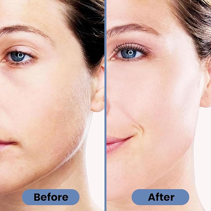 Infinity Choices Facial Hair Remover for Women – Electric Face Razor with Light, Hair Removal for Upper Lip, Chin & Cheeks – Color Blue