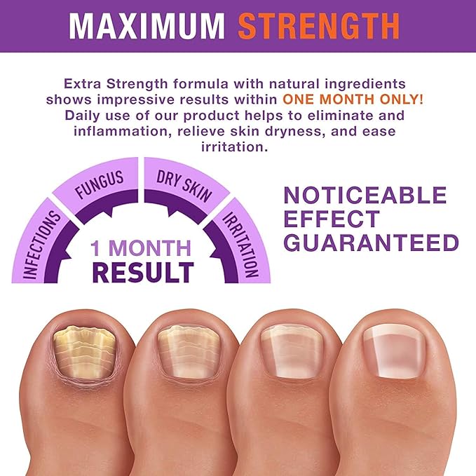 Toenail Fungus Treatment Extra Strength: Nail Fungus Treatment for Toenails and Fingernail for Damaged Discoloration Nails 1.0 Oz （New Formula）