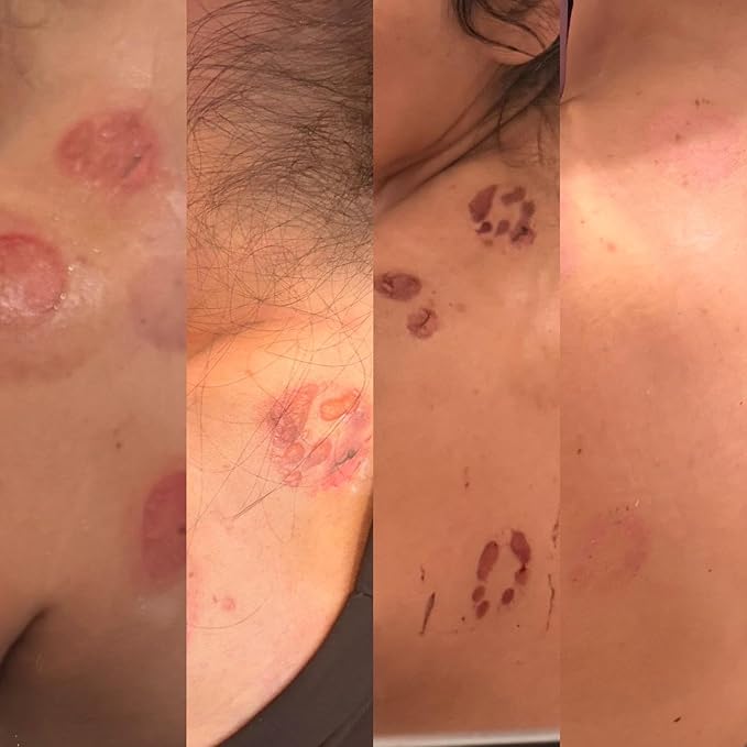 Natural Under Breast and Skin Care For Chafing and Irritation by La Parea Wellness (Revovery Balm)