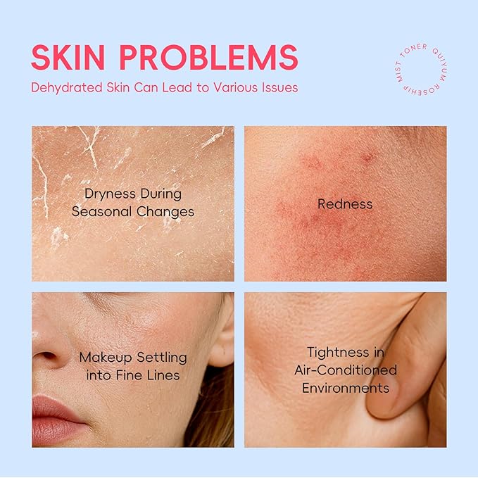 Rosehip & Vit-E Skin Care Sets for Women, Nourishes, Resists Oxidation, Promotes Collagen Production, Refine Skin Texture, Enhances Skin Elasticity, Skincare Gift Sets, for Dry Skin Type, 4PCS