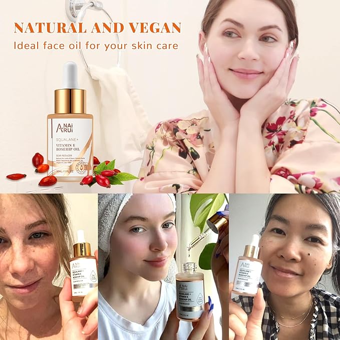 ANAI RUI Squalane + Vitamin E Rosehip Oil Moisturizer for Face,Hair,Skin& Nail Hydrate, Reduce Scars and Stretch Marks, Wrinkles for Smoother, Softer Skin 1 fl. Oz