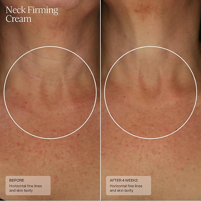 Senté Firming Neck Cream for Crepey Skin & Vertical Lines | Lifts, Firms & Smooths Neck & Décolleté | HSA, Caffeine, Vitamin C | 1.7 Fl Oz