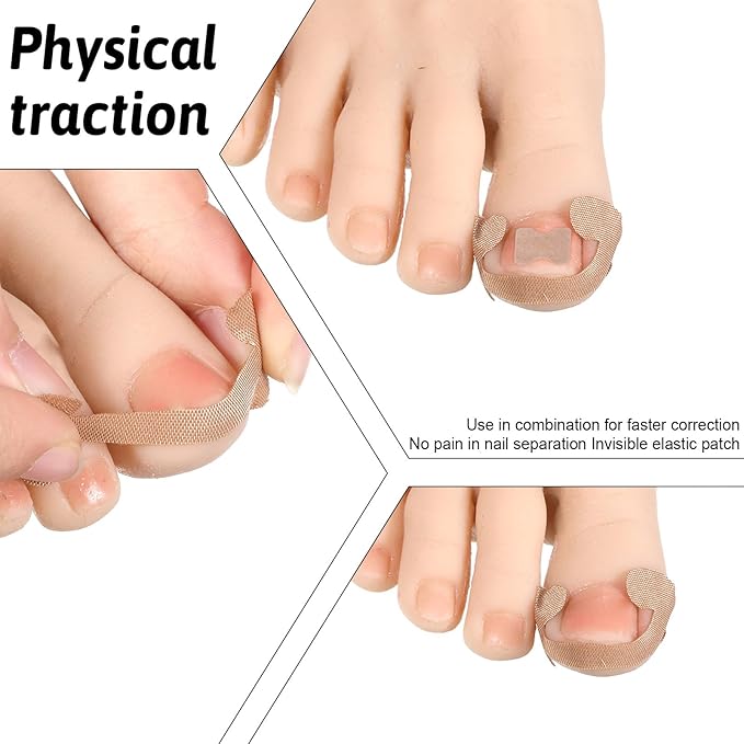 Professional Ingrown Toenail Corrector Set with Ingrown Toenail Strips, Curved Toenails Corrector Patch, Painless File and Lifter Pedicure Tools, Ingrowns Toenails Tools for Women and Man