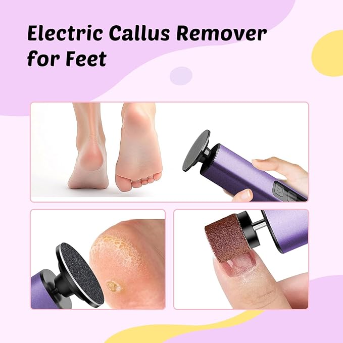 Dolcevitae Electric Foot Callus Remover - 9-Speed with Glass Crystal Grinding Disc & Storage Box, 80/120 Grit Sandpapers (20pcs), 10 Nail Heads, Type-C Fast Charge for Dead Skin