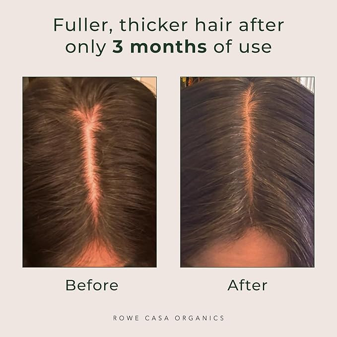 Rowe Casa Organics Natural Restorative Hair Spritz with Witch Hazel & Therapeutic Essential Oils, Hand-Crafted Hair Volumizer, Thickener, & Growth Booster, 4 Fl. Oz.