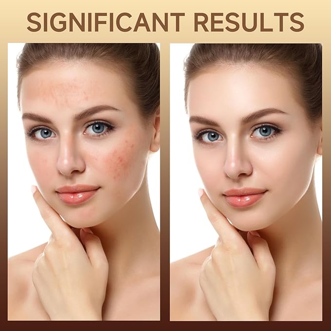 PDRN Serum Cream, 99% Pure Salmon DNA PDRN Advanced Face Moisturizer Cream with Collagen Hyaluronic Acid Niacinamide for Glass Glow Skin Hydration Uneven Skin Tone，20g, Unscented
