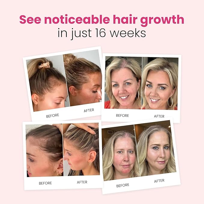 Trybello Hair Growth Shampoo | Natural Thickening & Scalp Detox | Aloe Vera, Turmeric, and Urucum Extract | Sulfate-Free, Vegan, Anti-Hair Fall Formula | For Any Hair Type | 2 Pack Combo