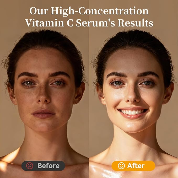 Vitamin C Serum for Face, 20% Natural Vitamin C Facial Serum with Sodium Hyaluronat Vitamin E, Anti Aging & Wrinkle Face Serum for Dark Spots & Fine Lines, All Type Skin Care 1 fl.oz+0.05 fl.oz x 10e