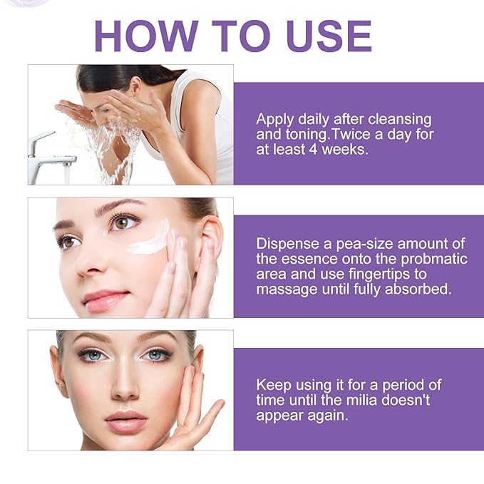 Milia Remover Serum for Eyes and Face, Milia Spot Remover with Salicylic Acid, Milia Acne Serum