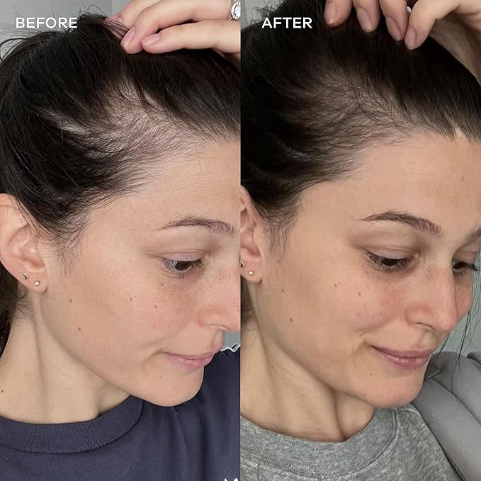 Vida Glow Marine Collagen Powder - Anti Aging Supplement with Collagen Peptides, Promotes Glowing Skin, Strong Nails, Healthy Hair | 30 Servings, Mango Flavor