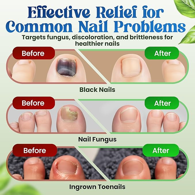 Premium Fungal Nail Patches Toe Nail Care Extra Fungus Strength 21 Pcs Nighttime Repair Damaged Treatment Toenail Discolored Nails 8 Hour Safe Sensitive gift for Valentine Day Women Men .(21 Count)