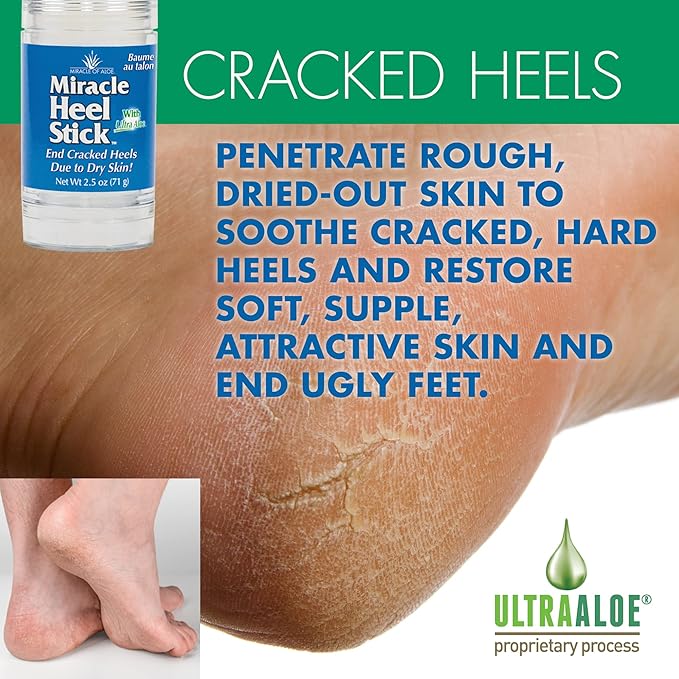 Heel Balm for Dry Cracked Feet - Miracle Heel Stick with Gel Socks - Moisturizes & Relieves Hard, Cracked Heels - Silicone Gel Infused Socks, Breathable & Washable - One Size Fits All