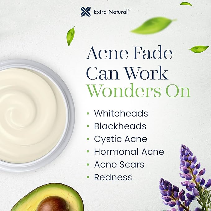 ExtraNatural Acne Cream – Natural & Gentle Acne Treatment for Sensitive & Oily Skin – Helps Reduce Breakouts, Pimples & Redness