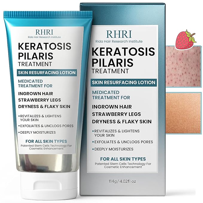 Keratosis Pilaris Treatment | Keratosis Pilaris Lotion with 10% AHA | Gentle Exfoliation For Strawberry Legs, KP & Ingrown Hairs | Smooth & Hydrating Body Lotion For Redness, Dry, Rough And Flaky Skin
