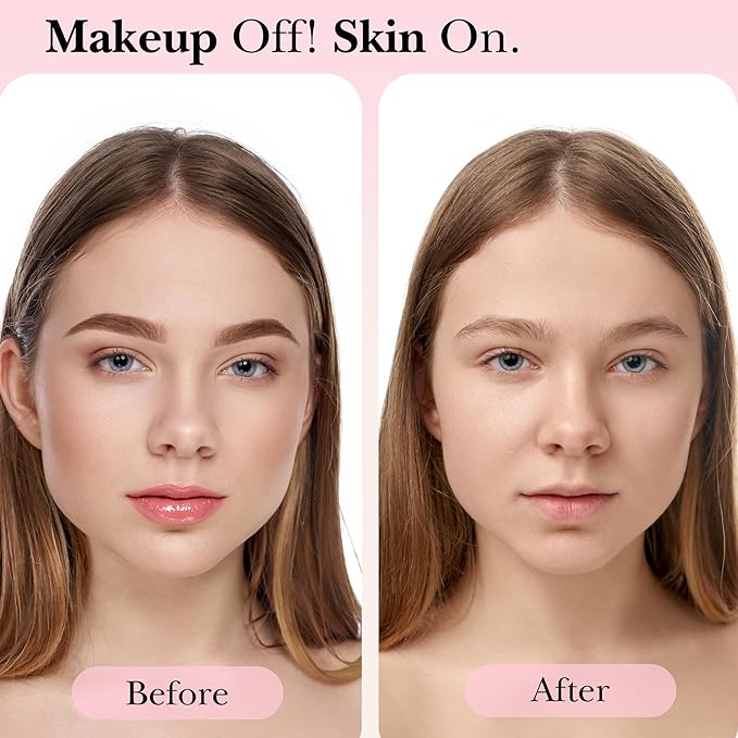 mivida Hypoallergenic Makeup Remover Wipes Bulk With Vitamin E, 200 count (4×50) Value Pack, Fragrance Free Makeup Wipes For Sensitive Skin, Alcohol Free Facial Make up Remover