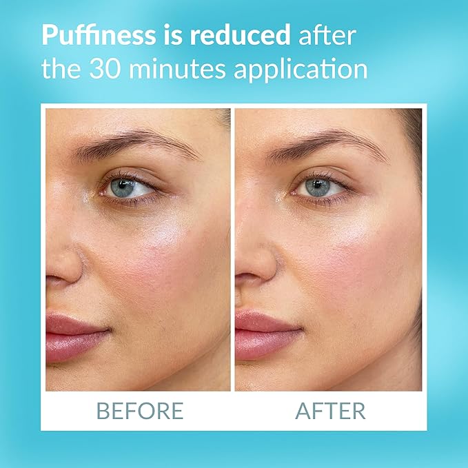 Talika Eye Therapy Patch - Instant Smoothing Under Eye Patches - For Dark Circles Puffiness & Tired Eyes - Reusable Under Eye Patch Skincare Eye Treatment