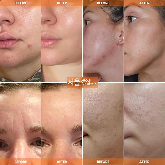 SeoulCeuticals Large 4oz 97.5% Snail Mucin Moisturizer Cream Korean Skin Care Day & Night Snail Repair for Face - K Beauty Anti Aging Facial Skincare