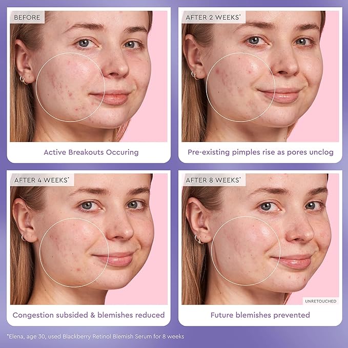 Glow Recipe Gentle Blackberry Retinol Night Serum - Anti Aging Korean Face Serum for Sensitive Skin + Hydrating Triple Retinoids & Glycerin to Clarify Blemishes, Smooth Texture, Lines & Wrinkles, 30ml