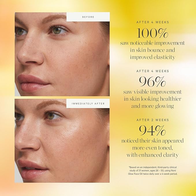 KORA Organics Noni Glow Hydrating Face Oil with Rosehip, Gua Sha Oil, Certified Organic, Cruelty Free, 0.34 fl oz