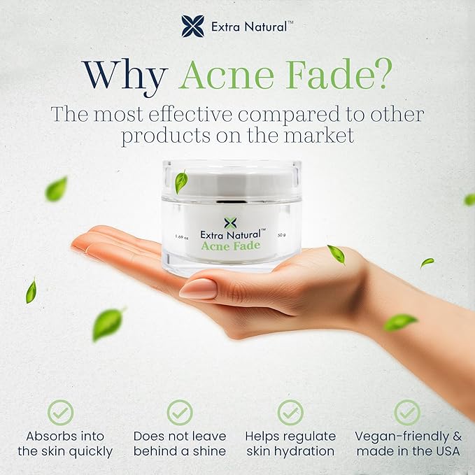 ExtraNatural Acne Cream – Natural & Gentle Acne Treatment for Sensitive & Oily Skin – Helps Reduce Breakouts, Pimples & Redness