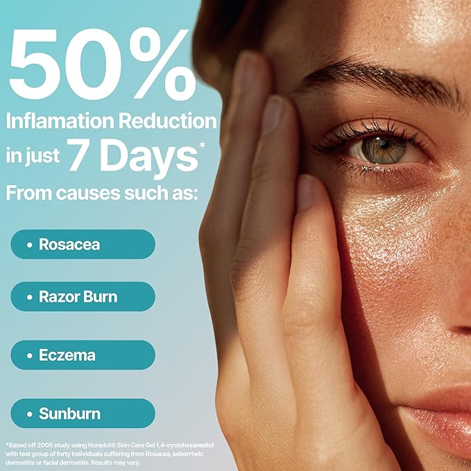 Redness Relieving Moisturizer for Face - Treatment for Dry Skin Facial Relief - Soothes Redness-Prone Skin and Irritation - Fragrance Free 0.5 oz