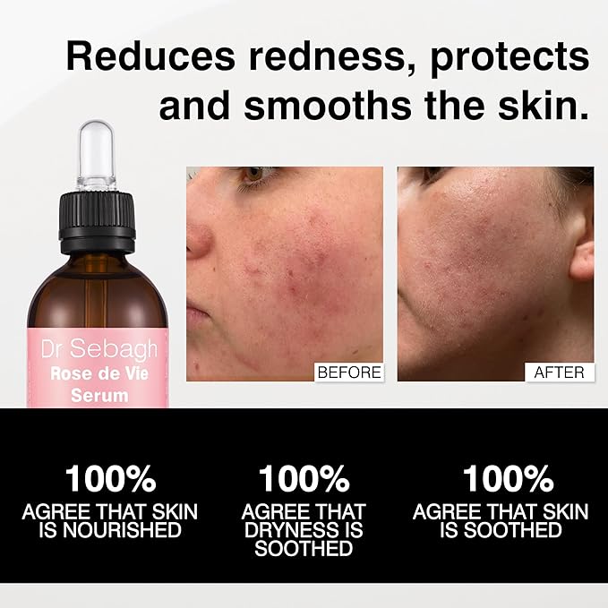 Dr Sebagh Rose de Vie Serum - 1.7 fl oz - Award-Winning Nourishing Anti-Aging Formula - Use with Dry, Mature, or Sensitive Skin - Designed to Soothe Redness & Irritation - Regenerating & Invigorating
