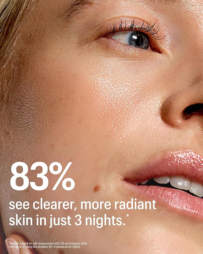 Allies of Skin Multi Acids & Retinoid Sleeping Facial | Exfoliating Overnight Glycolic Acid & AHA Peel | Resurfacing Anti-Aging Treatment For Fine Lines | Unclog Pores and Treat Blackheads 1.6 fl oz