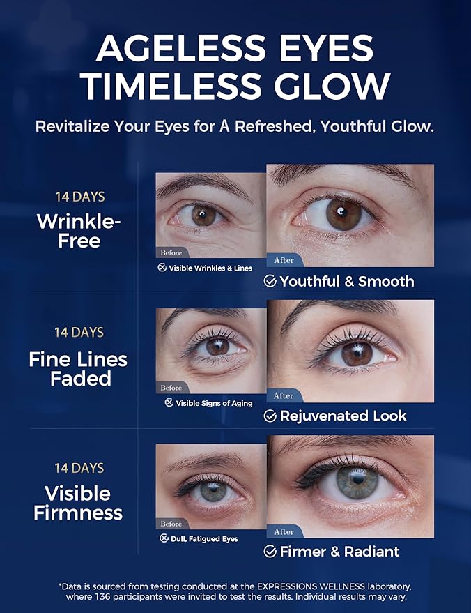 Under Eye Cream Anti Aging Peptides Eye Cream for Wrinkles with Niacinamide Reduce Fine Lines&Crow's Feet | Tightening and Firming for Women and Men 1.06 Oz Gold