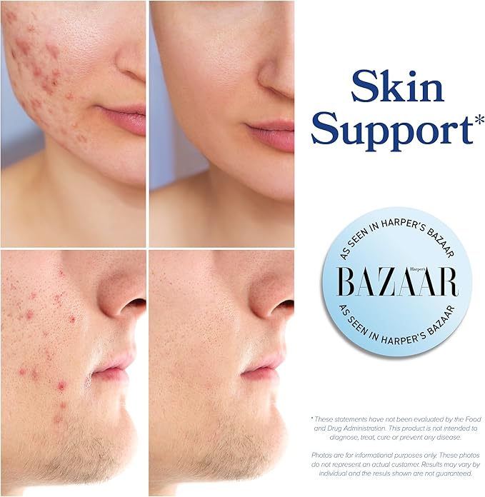 DIM Supplement 200 mg | Estrogen Balance for Women & Men | Hormonal Acne, Hormone Balance, Menopause & Antioxidant Support | Clean Label Project Certified, Vegan & Soy Free Diindolylmethane | 60 Ct.