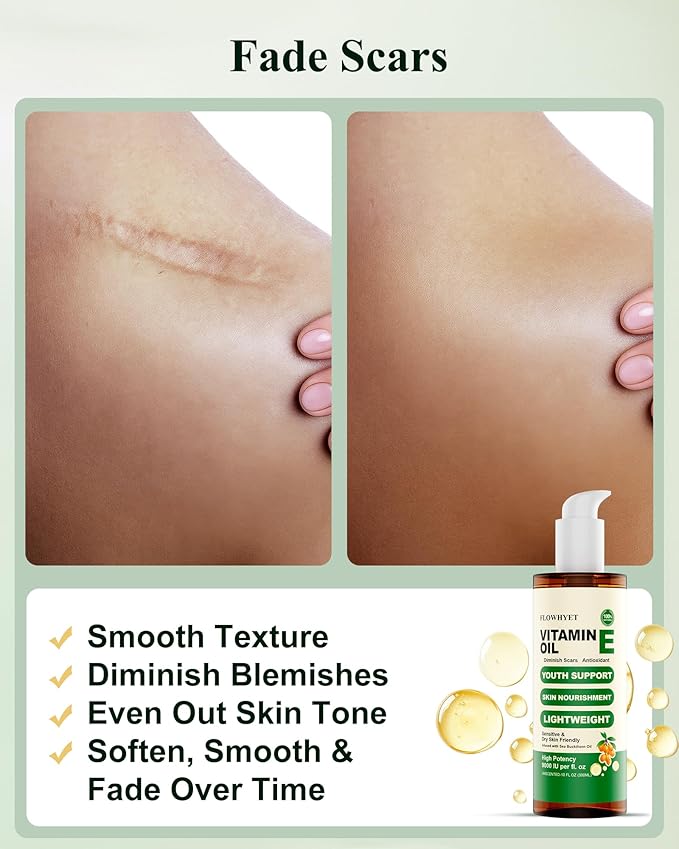 FLOWHYET 10 Floz Organic Vitamin E Oil, Pure Nail Oil vit e for Face, Skin, Body, Hair vitamins, Nourish Dry Skin, Maintain Youthful, Antioxidant, Fade Scars, Non-Greasy - 300ml