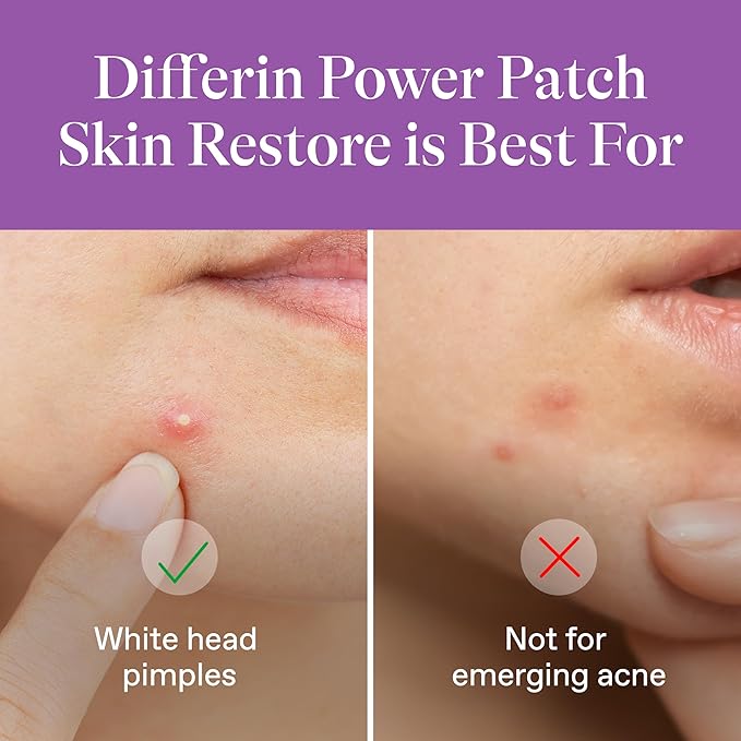 Differin Power Patches for White Head Pimples, Hydrocolloid Patches formulated with Zinc Hyaluronate and Niacinamide, 4-in-1 Hydrotech™ Formula, Helps Absorb Impurities and Restore Skin, 23 ct