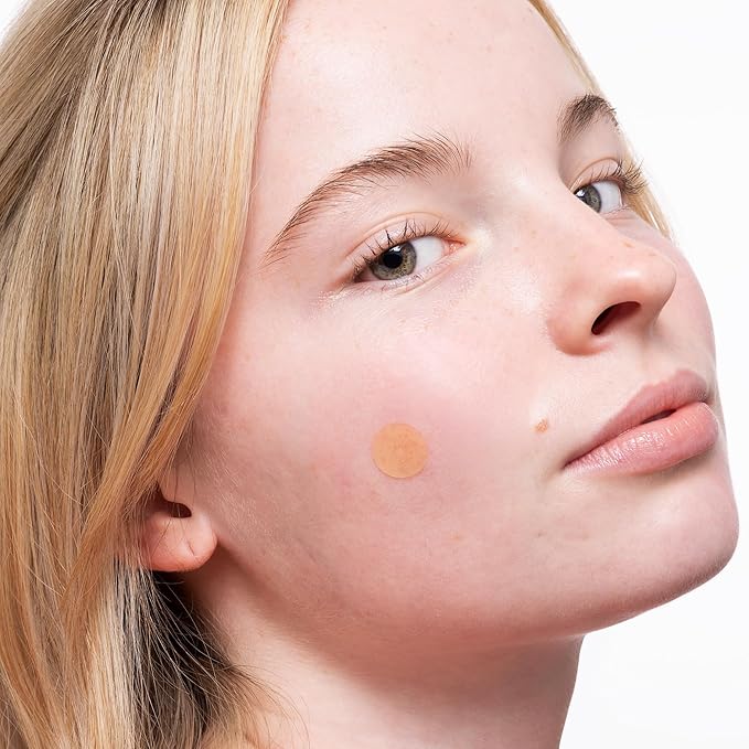 PEACE OUT Acne Healing Dots Helps Clear Blemishes Overnight, Fast Acting Hydrocolloid Pimple Patches for Breakouts with Salicylic Acid, Retinol and Aloe Vera, Award Winning Skincare Solution 20 Count