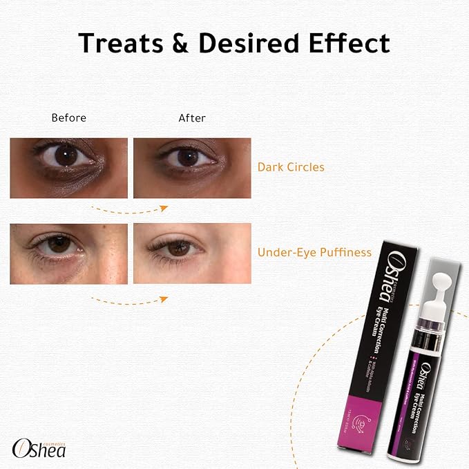 Eye Cream, 15 Ml / 0.5 Fl Oz, Hydrating & Brightening, Deep Conditioning Treatment, Reduces Puffiness & Dark Circles, Anti-Aging Formula