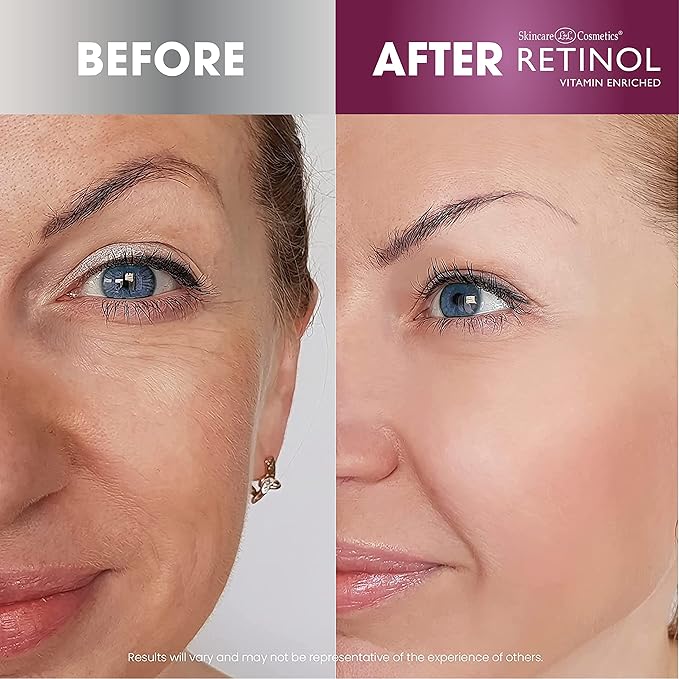 LIVAURA Retinol Anti-Aging, Vitamin Enriched Night Cream & Day Cream - Your 24 HOUR skincare duo that works day and night to give you younger-looking skin, 1 Ounce Each