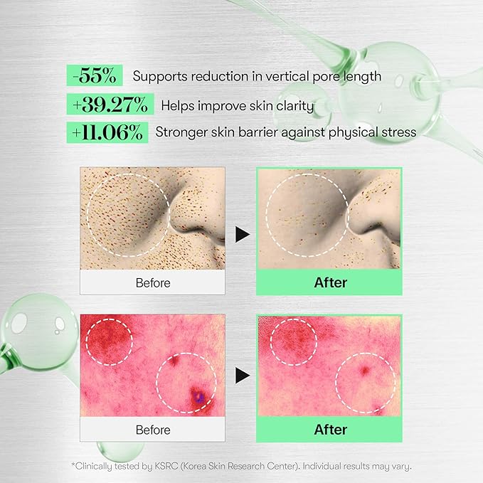 VT COSMETICS Reedle Shot 100 & PDRN Essence Set, Microneedling Serum and Glow Serum Duo for Glass Skin, Korean Skincare