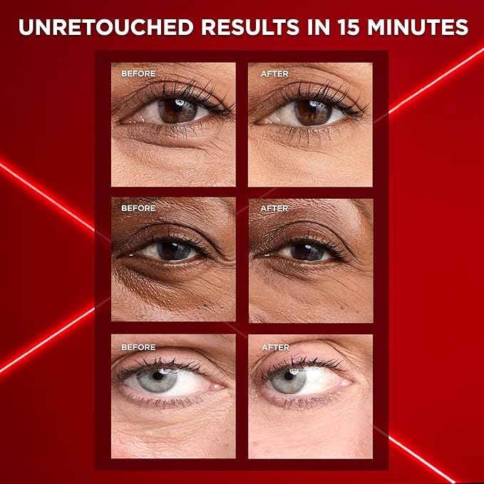 L'Oreal Paris Revitalift Triple Power Eye Bag Instant Eraser, Eye Tightener Treatment to Firm Bags, 0.5 oz + Sample